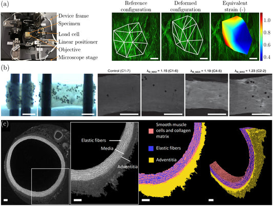 Revolutionizing Cardiovascular Disease Diagnosis: How Collagen Hybridizing Peptides Unveil Hidden Arterial Damage