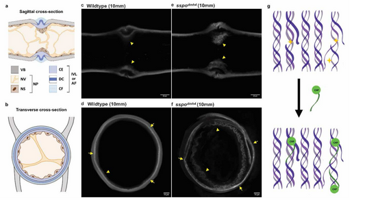 Insights into Collagen Damage and Spine Stiffness: Unraveling the Role of Oxidative stress in Scoliosis