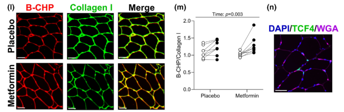 Metformin Pre-Treatment Improves ECM Remodeling and Collagen Turnover, Highlighted by CHP Use in Muscle Fibrosis