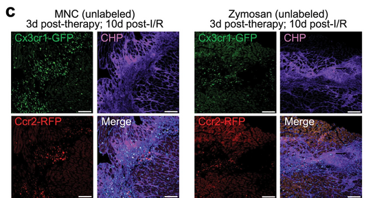 Cardiac Cell Therapy: Redefining the Path to Cardiac Repair